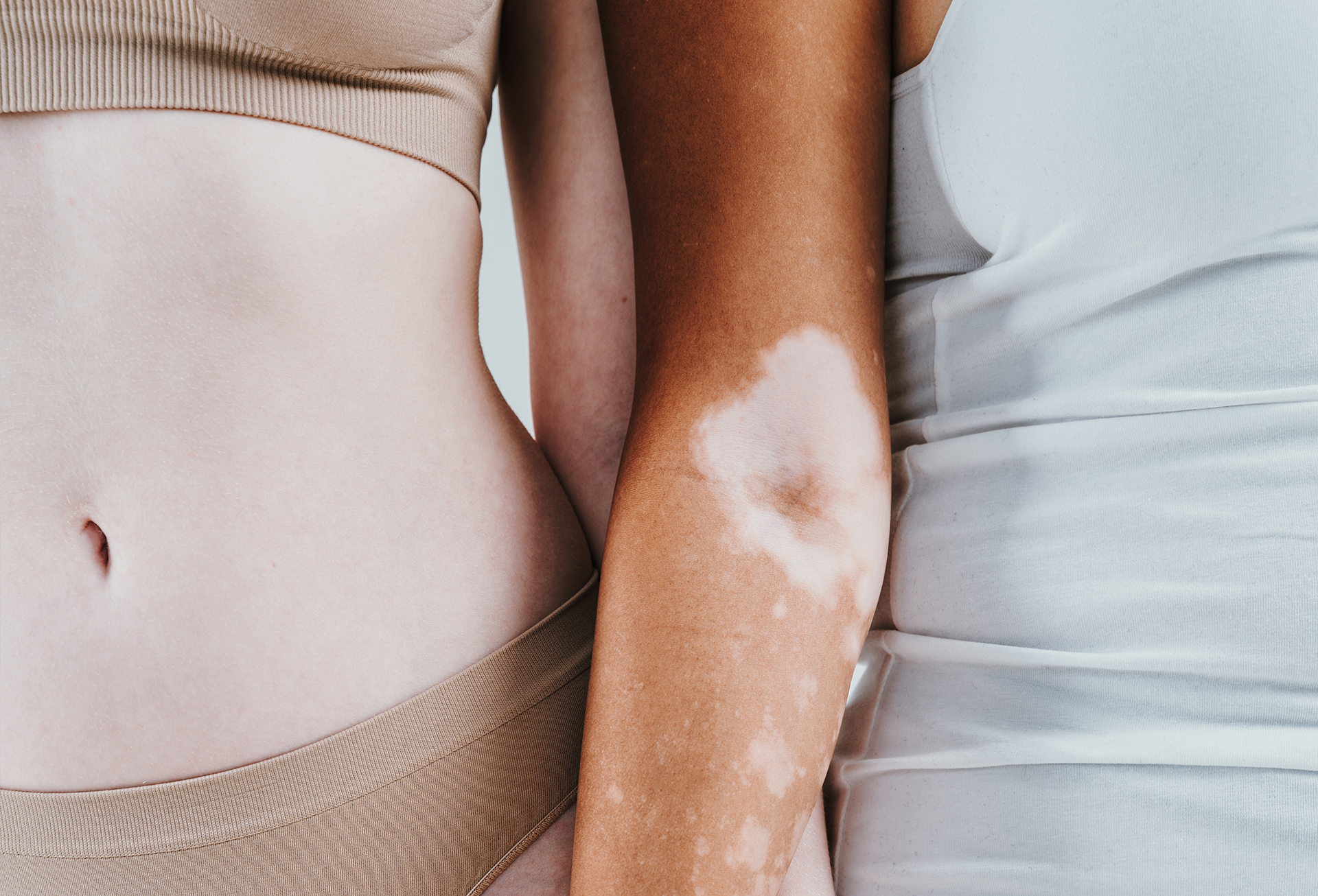 Terapia przebarwień