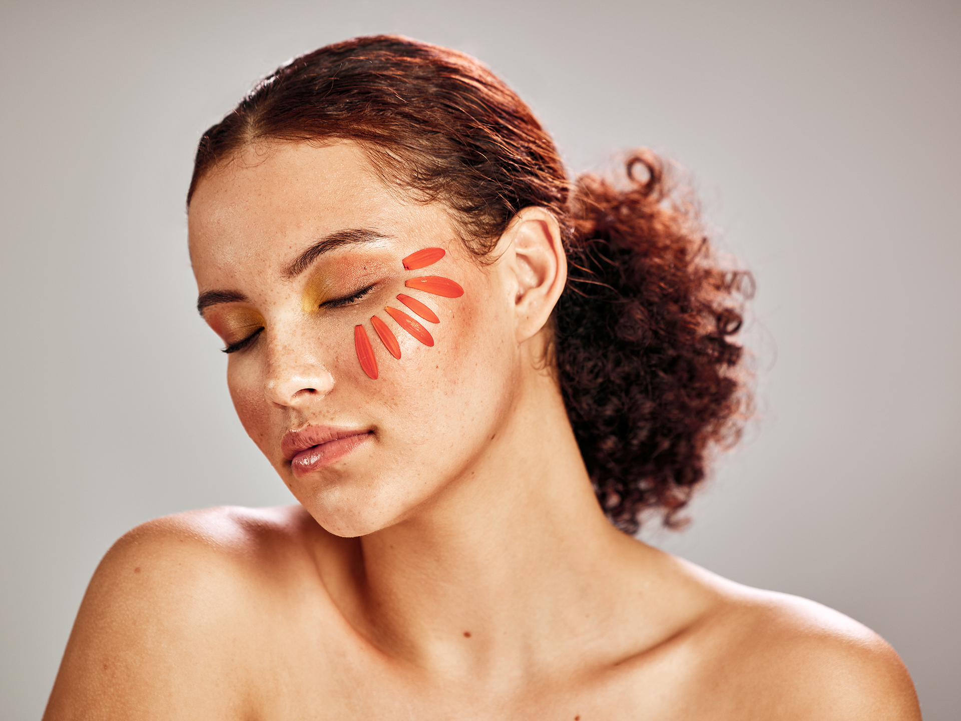 Trądzik różowaty – Rosacea